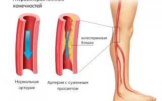 Узи брахиоцефальных артерий расшифровка норма
